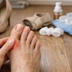 early sign of bunion