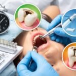 how long does a filling take